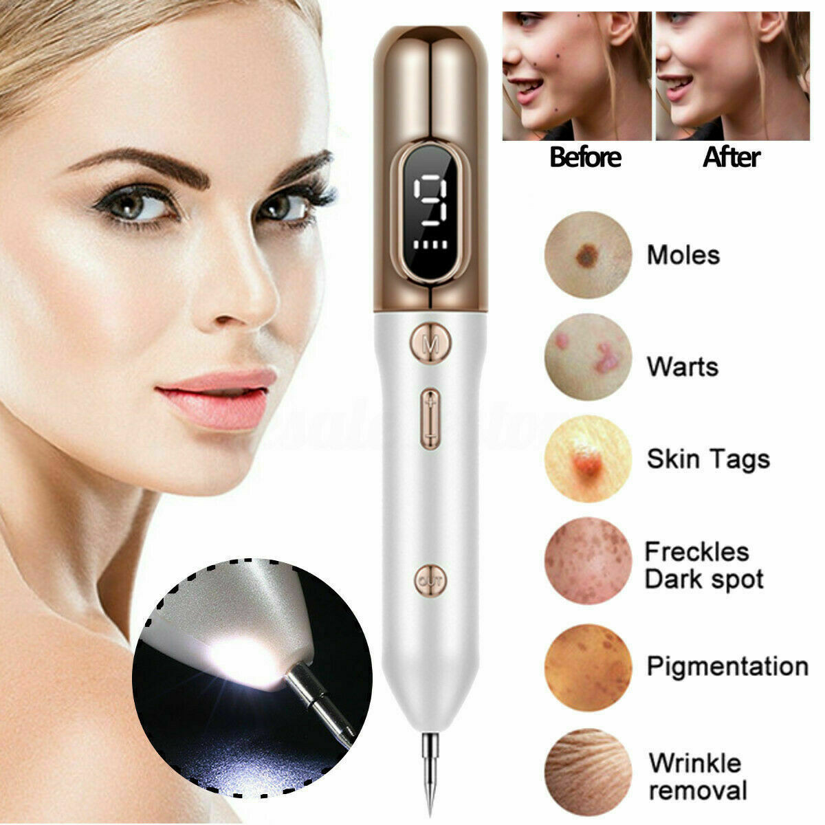 LCD Laser Plasma Pen Mole Removal Dark Spot Remover Skin Wart Tag Tattoo