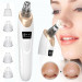 Electric Facial Skin Care Pore Blackhead Remover Cleaner Vacuum Acne Cleanser